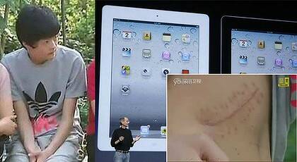 Xiao Zhang, the iPad 2 and his scar.