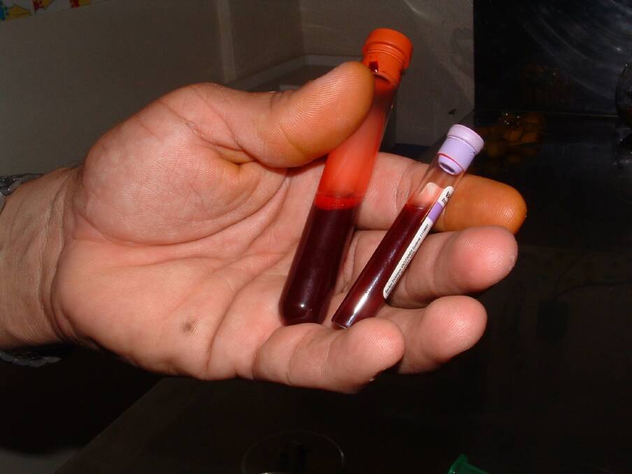 Blood tests can help COVID-19 researchers understand which cases are linked, but not always. The source of at least one Batemans Bay case remains a mystery.
