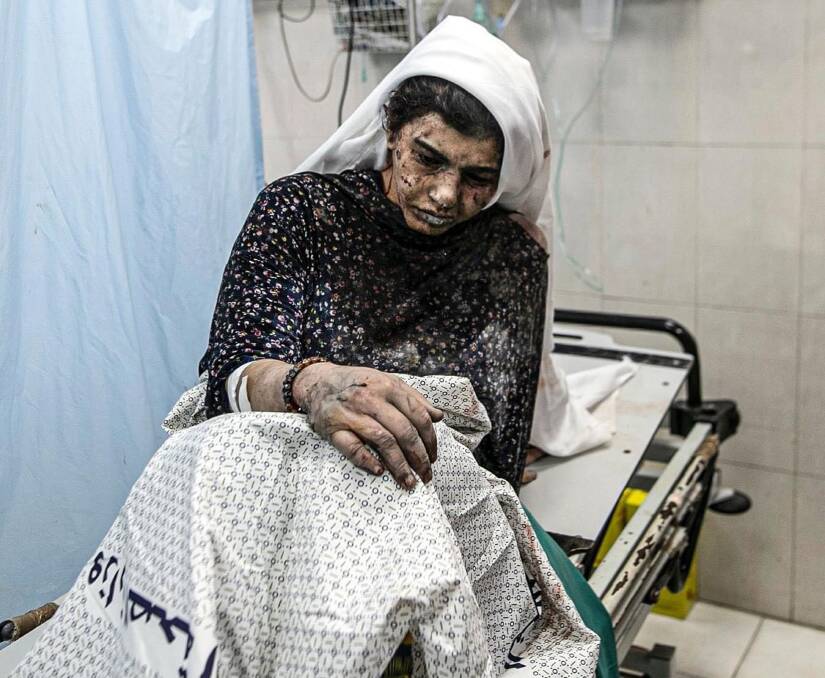 An injured Palestinian woman in hospital after her family home was bombed in Khan Yunis. Picture Getty Images